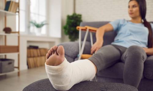 A female patient with a broken leg in a plaster cast and an arm support beside her seeking help from a personal injury lawyer after a boat accident in San Antonio.