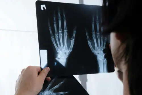 Doctor in white coat examining two hand X-ray films against a bright light, reviewing skeletal images for injury assessment